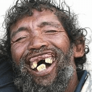 lachen zwerver tanden